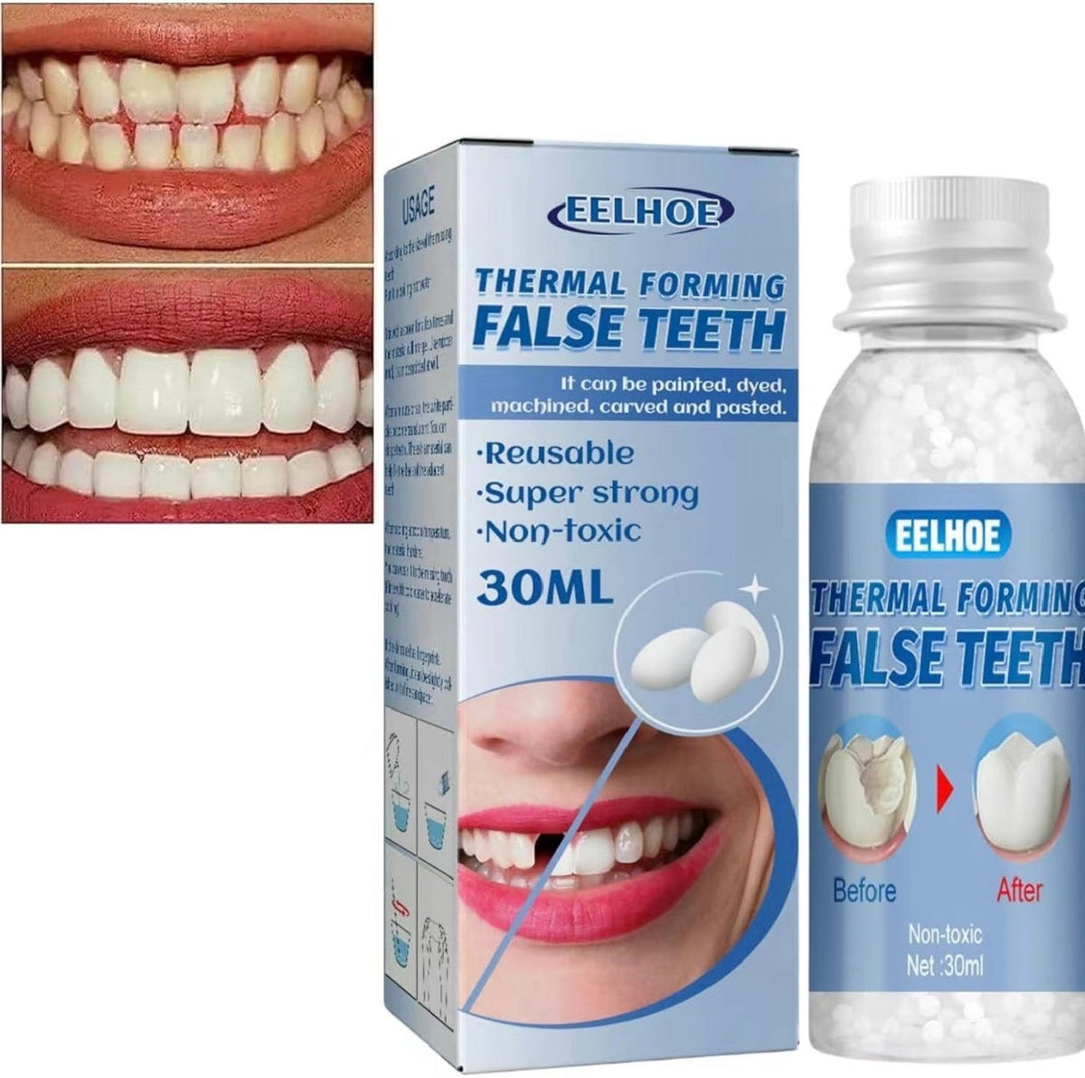 Moldable Temporary Dental Material, Two 30 ml Bottles