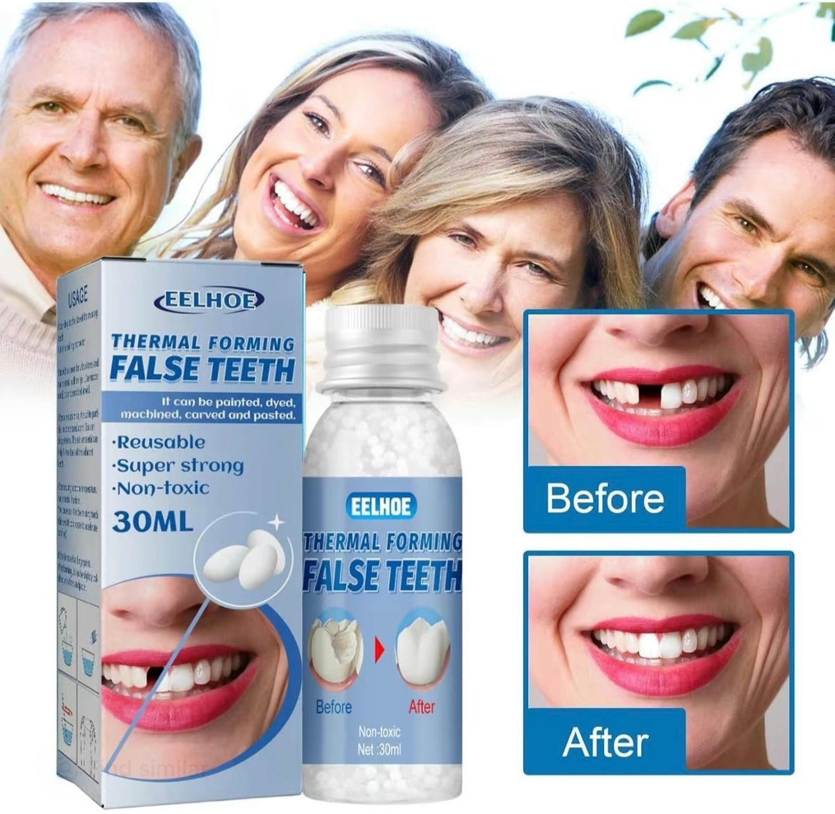 Moldable Temporary Dental Material, Two 30 ml Bottles